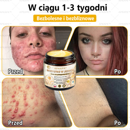 🎁🐝 Ostatnia szansa! Zgarnij to szczęśliwe znalezisko z 80% ZNIŻKĄ!