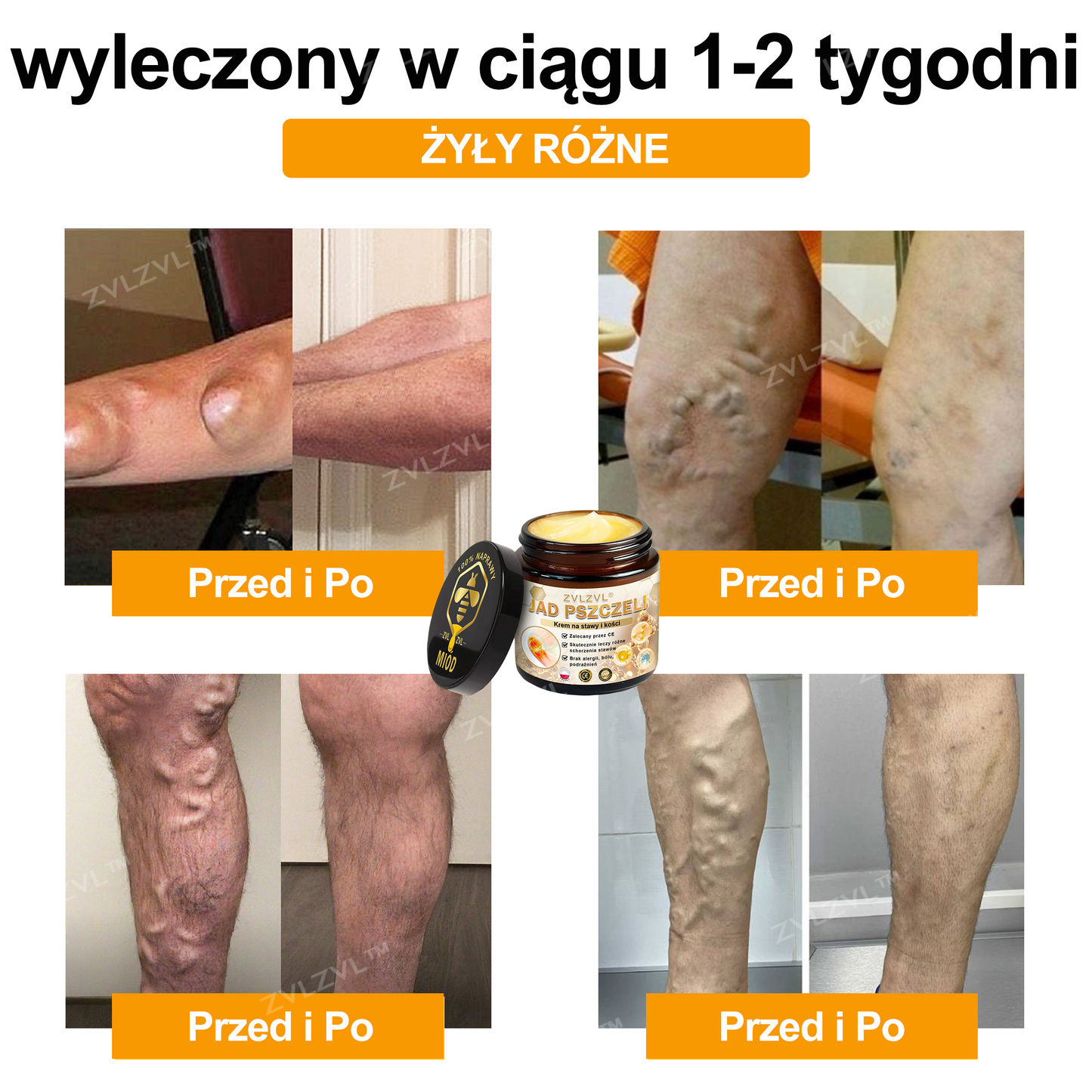 ZVLZVL™ - Krem łagodzący ból stawów z jadłem pszczelim