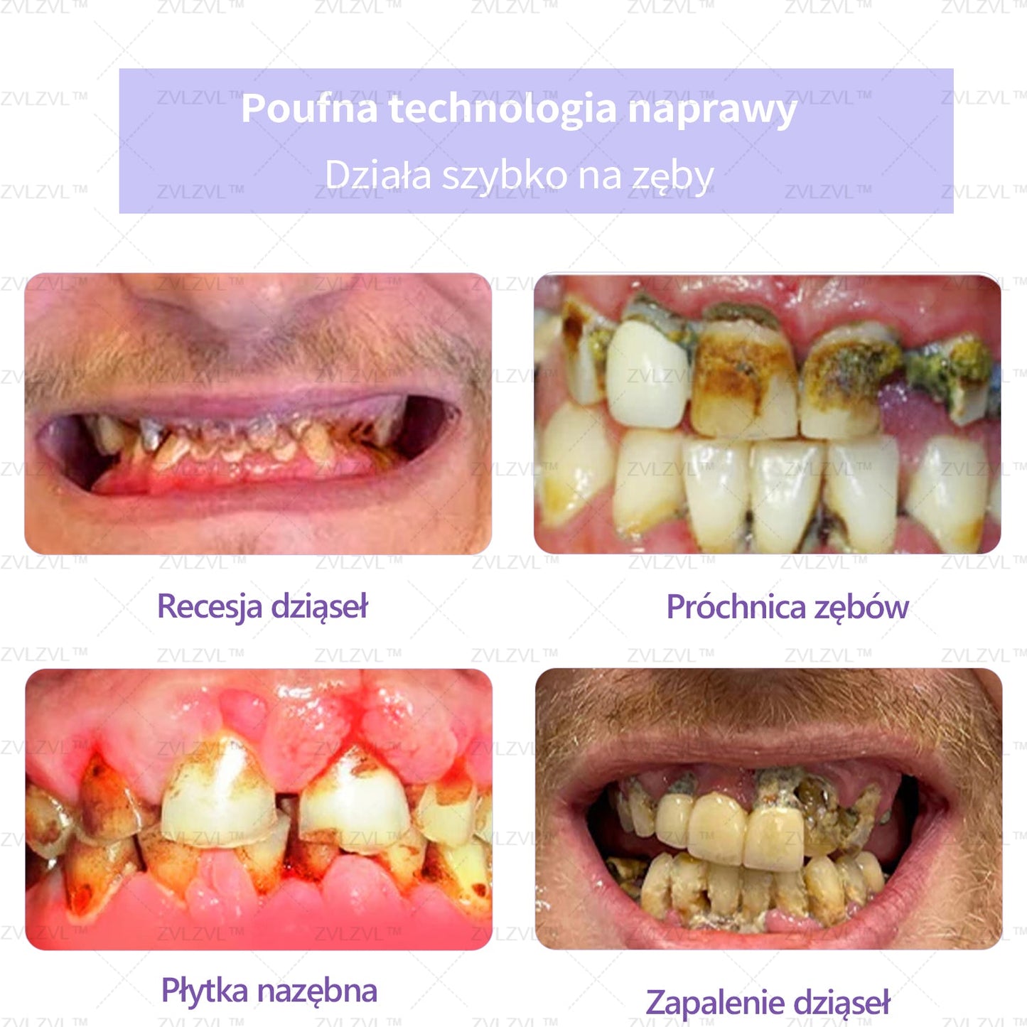 🎁 Zostało już tylko 5 pudełek! Zapewniamy również dodatkowy rabat 50%! Ciesz się białymi i zdrowymi zębami już teraz. Jeżeli przegapicie teraz, nadrobicie zaległości dopiero w przyszłym roku!